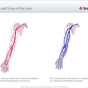 Closure Varicose Vein - Varicose Veins Diagnosis