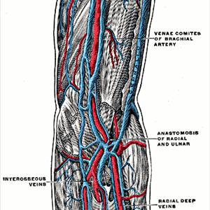 Mount Varicose - Varicose Veins More That A Cosmetic Concern