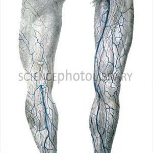 Varicose Scrotal Veins - How To Find The Best Varicose Veins Treatment Centre