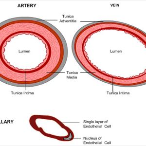 Vulvar Varicosities Discussion - Levels Of Concern With Varicose Vein Treatment