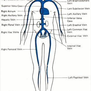 Vericose Veins Pictures - Say Goodbye To Spider And Varicose Veins Now! 