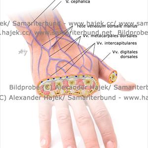 Herb Varicose Vein - Alternative Treatment For Varicose Veins